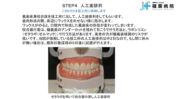 総義歯製作の新たな取り組み スライド画像10