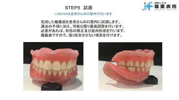 総義歯製作の新たな取り組み スライド画像11