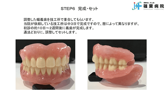 総義歯製作の新たな取り組み スライド画像12